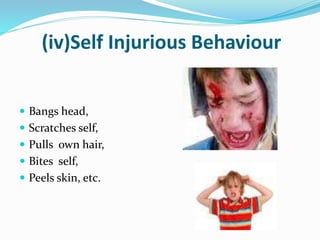 (iv)Self Injurious Behaviour
 Bangs head,
 Scratches self,
 Pulls own hair,
 Bites self,
 Peels skin, etc.
 