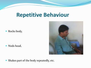 Repetitive Behaviour
 Rocks body,
 Nods head,
 Shakes part of the body repeatedly, etc.
 