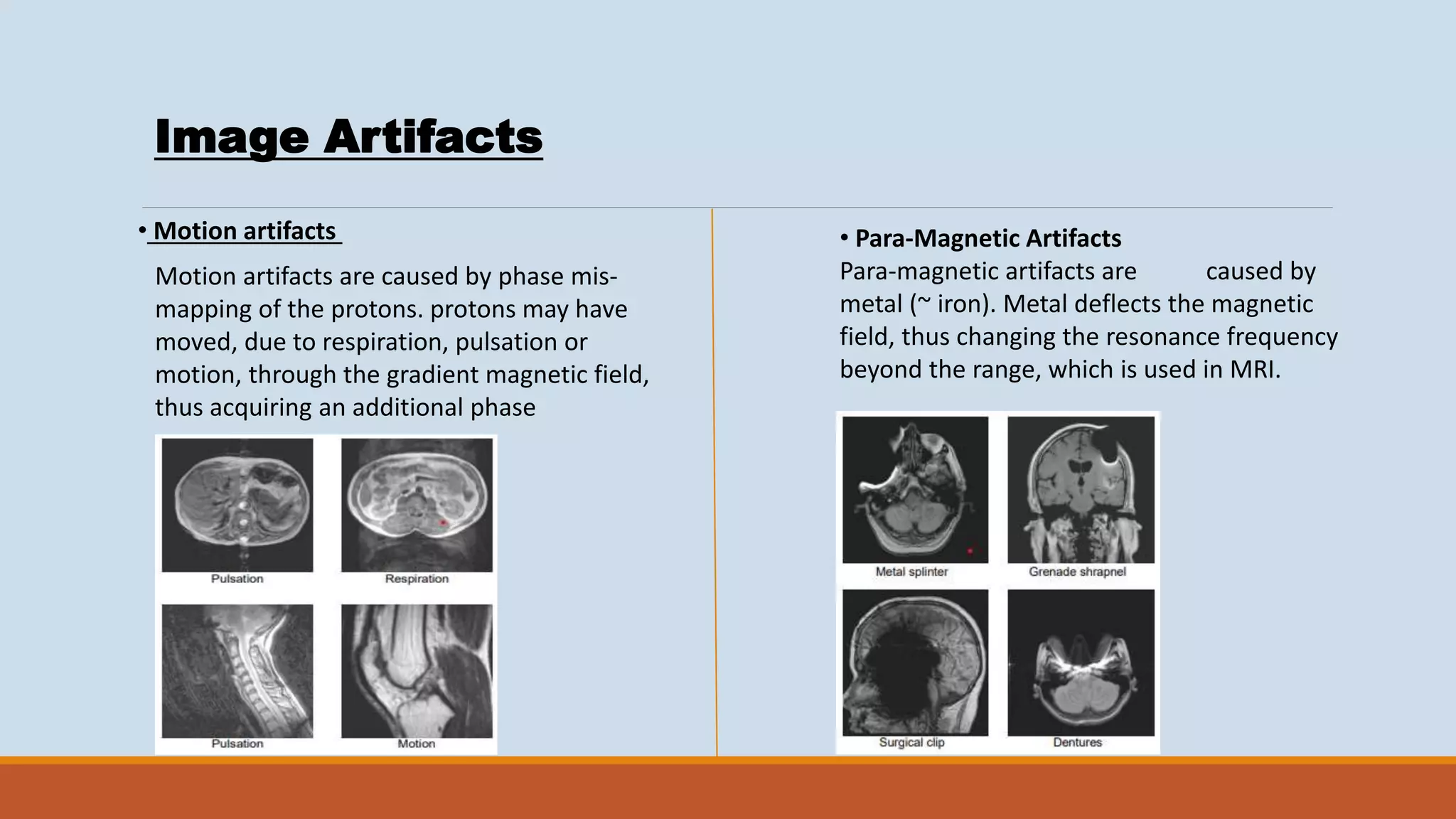 BASIC MRI.pptx