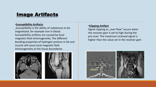 BASIC MRI.pptx