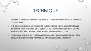 TECHNIQUE
1. THE TYPICAL CHEMICAL SHIFT MRI SEQUENCE IS T1 WEIGHTED SPOILED DUASL GRADIENT
ECHO SEQUENCE
2. IT IS USED WITHOUT FAT SUPRESSION TO AVOID MASKING INDIAN INK ARTEFACT AND
BEFORE THE ADMINISTRATION OF IV CONTRAST TO AVOID ALTERATIONS IN T1 SIGNAL
INTENSITY THAT MAY OBSCURE CHEMICAL SHIFT SIGNAL INTENSITY LOSS.
3. THE IN PHASE AND OUT OF PHASE IMAGES SHOULD BE VIEWED SIMULTANEOUSLY ON A
SINGLE MONITOR TO AVOID ARTIFACTUAL DIFFERENCE IN SIGNAL INTENSITY.
 