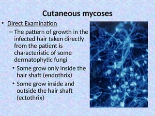 Basic mycology. Cutaneos and subcutaneous mycoses 2022. ppt (1)-1.ppt