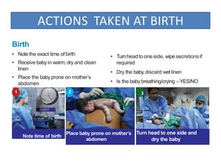 ACTIONS TAKEN AT BIRTH
Birth
• Note the exact time of birth
• Receive baby in warm, dry and clean
linen
• Place the baby prone on mother’s
abdomen
1
Note time of birth
Place baby prone on mother’s
abdomen
Turn head to one side and
dry the baby
2
• Turnhead to one side, wipesecretions if
required
• Dry the baby, discard wetlinen
• Is the baby breathing/crying –YES/NO
3
 