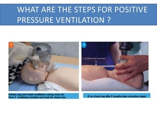 WHAT ARE THE STEPS FOR POSITIVE
PRESSURE VENTILATION ?
If no chest rise after 5 breaths take corrective steps
1
1 2
Initiate bag and mask ventilation using room air.
Give 5 ventilatory breaths and look for chest rise
 