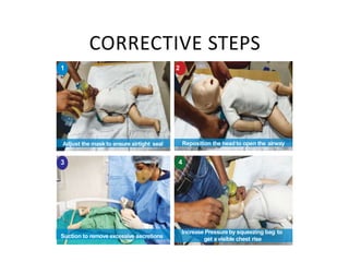 CORRECTIVE STEPS
Reposition the head to open the airway
Adjust the mask to ensure airtight seal
Increase Pressure by squeezing bag to
get a visible chest rise
4
1 2
3
Suction to remove excessive secretions
 