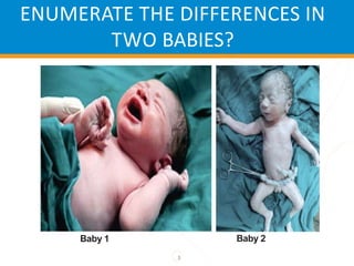 ENUMERATE THE DIFFERENCES IN
TWO BABIES?
3
Baby 1 Baby 2
 