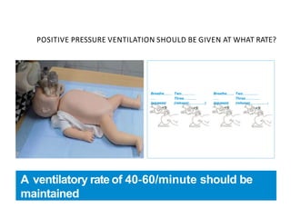 POSITIVE PRESSURE VENTILATION SHOULD BE GIVEN AT WHAT RATE?
A ventilatory rate of 40‐60/minute should be
maintained
Breathe.............
........
Two.....................
Three.....................
Breathe............
.........
Two.......................
Three.......................
(squeeze) (release)..........................) (squeeze) (release)............................)
 