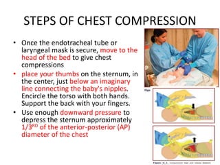 STEPS OF CHEST COMPRESSION
• Once the endotracheal tube or
laryngeal mask is secure, move to the
head of the bed to give chest
compressions
• place your thumbs on the sternum, in
the center, just below an imaginary
line connecting the baby's nipples.
Encircle the torso with both hands.
Support the back with your fingers.
• Use enough downward pressure to
depress the sternum approximately
1/3RD of the anterior-posterior (AP)
diameter of the chest
 