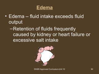 DHSR Approved Curriculum-Unit 10 90
Edema
• Edema – fluid intake exceeds fluid
output
–Retention of fluids frequently
caused by kidney or heart failure or
excessive salt intake
 