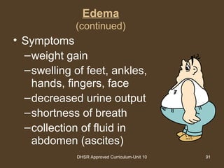 DHSR Approved Curriculum-Unit 10 91
Edema
(continued)
• Symptoms
–weight gain
–swelling of feet, ankles,
hands, fingers, face
–decreased urine output
–shortness of breath
–collection of fluid in
abdomen (ascites)
 