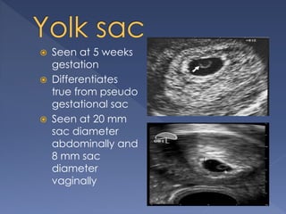  Seen at 5 weeks
gestation
 Differentiates
true from pseudo
gestational sac
 Seen at 20 mm
sac diameter
abdominally and
8 mm sac
diameter
vaginally
 