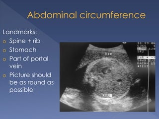 Landmarks:
o Spine + rib
o Stomach
o Part of portal
vein
o Picture should
be as round as
possible
 