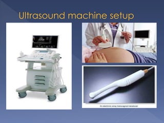  Definition of Ultrasound
Ultrasound means sound waves of frequency
higher than those heard by the human ear.
SAFETY
no ...