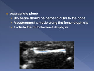 Basic Obstetric Ultrasound