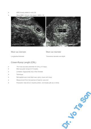 •

MSD closely related to early GA

•

When MSD > 25 mm. GA (days) = MSD + 30

Mean sac diameter

Mean sac diameter

Longitudinal diameter

Transverse diameter and depth

Crown-Rump Length (CRL)
•
•

The most accurate parameter for GA (+ 3-7 days)

•

Limitation: Appropriate only in first trimester

•

Technique:

•

Mid-sagittal scan (note fetal nose, spine, crown and rump)

•

Measurement from the topmost of head to rump end

•

Precaution: best done in neutral position, not include yolk sac or limbs

Most accurate during 6.5-10 weeks

 