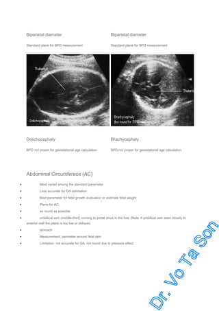 Biparietal diameter

Biparietal diameter

Standard plane for BPD measurement

Standard plane for BPD measurement

Dolichocephaly

Brachycephaly

BPD not proper for gestatational age calculation

BPD not proper for gestatational age calculation

Abdominal Circumferece (AC)
•

Most varied among the standard parameter

•

Less accurate for GA estimation

•

Best parameter for fetal growth evaluation or estimate fetal weight

•

Plane for AC:

•

as round as possible

•

umbilical vein (middle-third) running to portal sinus in the liver (Note: if umbilical vein seen closely to
anterior wall the plane is too low or oblique)

•

stomach

•

Measurement: perimeter around fetal skin

•

Limitation: not accurate for GA, not round due to pressure effect

 