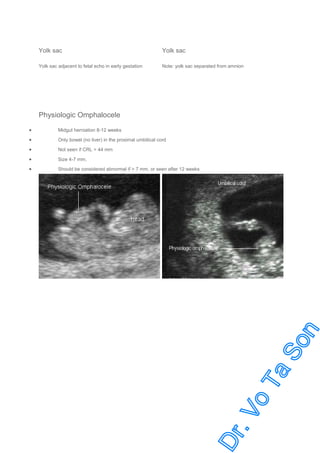 Yolk sac

Yolk sac

Yolk sac adjacent to fetal echo in early gestation

Note: yolk sac separated from amnion

Physiologic Omphalocele
•

Midgut herniation 8-12 weeks

•

Only bowel (no liver) in the proximal umbilical cord

•

Not seen if CRL > 44 mm

•

Size 4-7 mm.

•

Should be considered abnormal if > 7 mm, or seen after 12 weeks

 