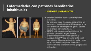 Enfermedades con patrones hereditarios
inhabituales • DISOMIA UNIPARENTAL
• Este fenómeno se explica por la impronta
genómica.
• La impronta es un fenómeno epigenético, un
cambio no hereditario en el ADN que provoca
una alteración de la expresión génica basada
en el origen parental del gen.
• El SPW está causado por la deficiencia del
producto proteico del gen SNRPN
(ribonucleoproteína nuclear pequeña).
• Aunque el SNRPN está presente tanto en el
cromosoma 15 procedente de la madre como
en el procedente del padre, se expresa
exclusivamente en el cromosoma que proviene
del padre.
 