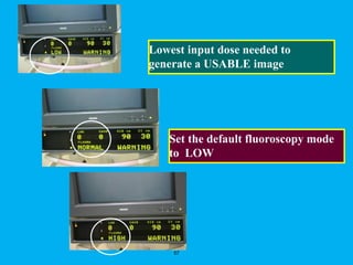 57
Set the default fluoroscopy mode
to LOW
Lowest input dose needed to
generate a USABLE image
 