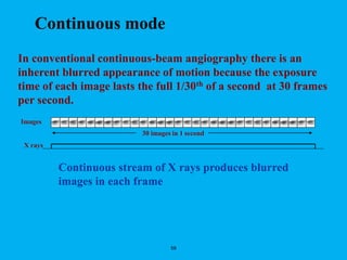59
30 images in 1 second
X rays
In conventional continuous-beam angiography there is an
inherent blurred appearance of motion because the exposure
time of each image lasts the full 1/30th of a second at 30 frames
per second.
Continuous stream of X rays produces blurred
images in each frame
Images
Continuous mode
 