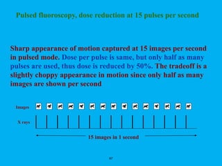 67
Pulsed fluoroscopy, dose reduction at 15 pulses per second
Sharp appearance of motion captured at 15 images per second
in pulsed mode. Dose per pulse is same, but only half as many
pulses are used, thus dose is reduced by 50%. The tradeoff is a
slightly choppy appearance in motion since only half as many
images are shown per second
Images
X rays
15 images in 1 second
 