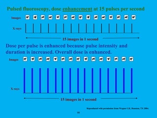 68
Pulsed fluoroscopy, dose enhancement at 15 pulses per second
Dose per pulse is enhanced because pulse intensity and
duration is increased. Overall dose is enhanced.
Images
X rays
15 images in 1 second
Reproduced with permission from Wagner LK, Houston, TX 2004.
Images
X rays
15 images in 1 second
 