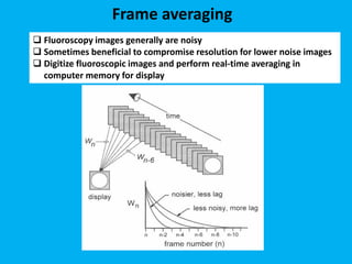 Frame averaging
 Fluoroscopy images generally are noisy
 Sometimes beneficial to compromise resolution for lower noise images
 Digitize fluoroscopic images and perform real-time averaging in
computer memory for display
 