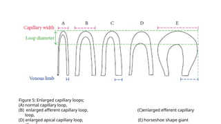 Apical Loop Basic knowledges of Capillaroscope.pptx