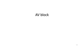 AV block
112
 
