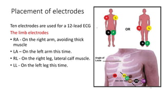 Placement of electrodes
Ten electrodes are used for a 12-lead ECG
The limb electrodes
• RA - On the right arm, avoiding thick
muscle
• LA – On the left arm this time.
• RL - On the right leg, lateral calf muscle.
• LL - On the left leg this time.
13
 
