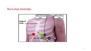 The 6 chest electrodes
14
 