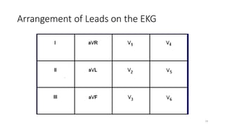 Arrangement of Leads on the EKG
19
 