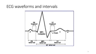 ECG waveforms and intervals
22
 