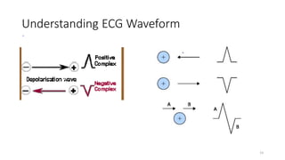Understanding ECG Waveform
23
 