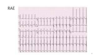 RAE
28
 