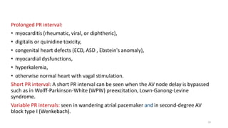 Prolonged PR interval:
• myocarditis (rheumatic, viral, or diphtheric),
• digitalis or quinidine toxicity,
• congenital heart defects (ECD, ASD , Ebstein's anomaly),
• myocardial dysfunctions,
• hyperkalemia,
• otherwise normal heart with vagal stimulation.
Short PR interval: A short PR interval can be seen when the AV node delay is bypassed
such as in Wolff-Parkinson-White (WPW) preexcitation, Lown-Ganong-Levine
syndrome.
Variable PR intervals: seen in wandering atrial pacemaker and in second-degree AV
block type I (Wenkebach).
32
 
