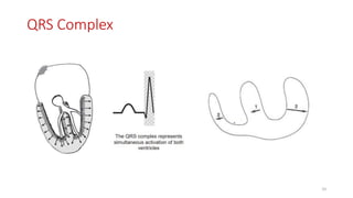 QRS Complex
33
 