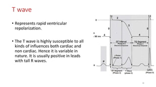 T wave
• Represents rapid ventricular
repolarization.
• The T wave is highly susceptible to all
kinds of influences both cardiac and
non cardiac. Hence it is variable in
nature. It is usually positive in leads
with tall R waves.
38
 