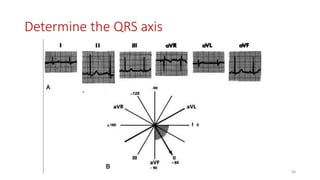 Determine the QRS axis
46
 