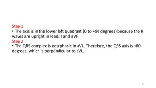Step 1
• The axis is in the lower left quadrant (0 to +90 degrees) because the R
waves are upright in leads I and aVF.
Step 2
• The QRS complex is equiphasic in aVL. Therefore, the QRS axis is +60
degrees, which is perpendicular to aVL.
47
 