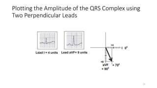 Plotting the Amplitude of the QRS Complex using
Two Perpendicular Leads
53
 