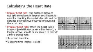 Calculating the Heart Rate
• Regular heart rate - The distance between
two QRS complexes in large or small boxes is
used for counting the ventricular rate and the
distance between two P waves for counting
the atrial rate.
• Irregular heart rate: When the heart rate is
irregular (atrial flutter or atrial fibrillation), a
longer interval should be measured to provide
a more precise rate.
3- second time line
6-second time interval is used
55
 