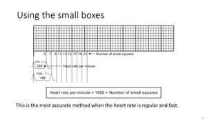 Using the small boxes
This is the most accurate method when the heart rate is regular and fast.
57
 