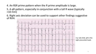 4. An RSR prime pattern when the R prime amplitude is large.
5. A qR pattern, especially in conjunction with a tall R wave (typically
>10 mm)
6. Right axis deviation can be used to support other findings suggestive
of RVH.
3 yr old child, qR in the
right precordial leads
75
 