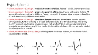 Hyperkalemia
• Serum potassium > 5.5 mEq/L - repolarization abnormalities. Peaked T waves, shorter QT interval.
• Serum potassium > 6.5 mEq/L - progressive paralysis of the atria. P wave widens and flattens, PR
segment lengthens resulting in AV block, P waves eventually disappear. More pronounced peaking
of the T waves occur, QRS complexes widen.
• Serum potassium > 7.0 mEq/L - conduction abnormalities and bradycardia. P waves become
unrecognizable, further widening of the QRS complex occurs, S and T waves merge with a very
short ST segment resulting in a sinusoidal wave. High-grade AV block with slow junctional and
ventricular escape rhythms, any kind of conduction block (bundle branch blocks, fascicular blocks),
sinus bradycardia or slow AF.
• Serum potassium level of > 9.0 mEq/L : slowing of the heart rate, asystole, or ventricular flutter
(causes cardiac arrest).
81
 