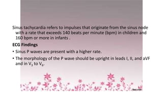 Sinus tachycardia refers to impulses that originate from the sinus node
with a rate that exceeds 140 beats per minute (bpm) in children and
160 bpm or more in infants .
ECG Findings
• Sinus P waves are present with a higher rate.
• The morphology of the P wave should be upright in leads I, II, and aVF
and in V3 to V6.
 
