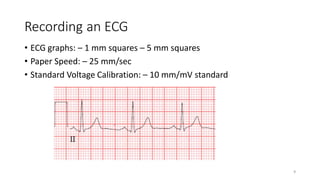 Recording an ECG
• ECG graphs: – 1 mm squares – 5 mm squares
• Paper Speed: – 25 mm/sec
• Standard Voltage Calibration: – 10 mm/mV standard
9
 