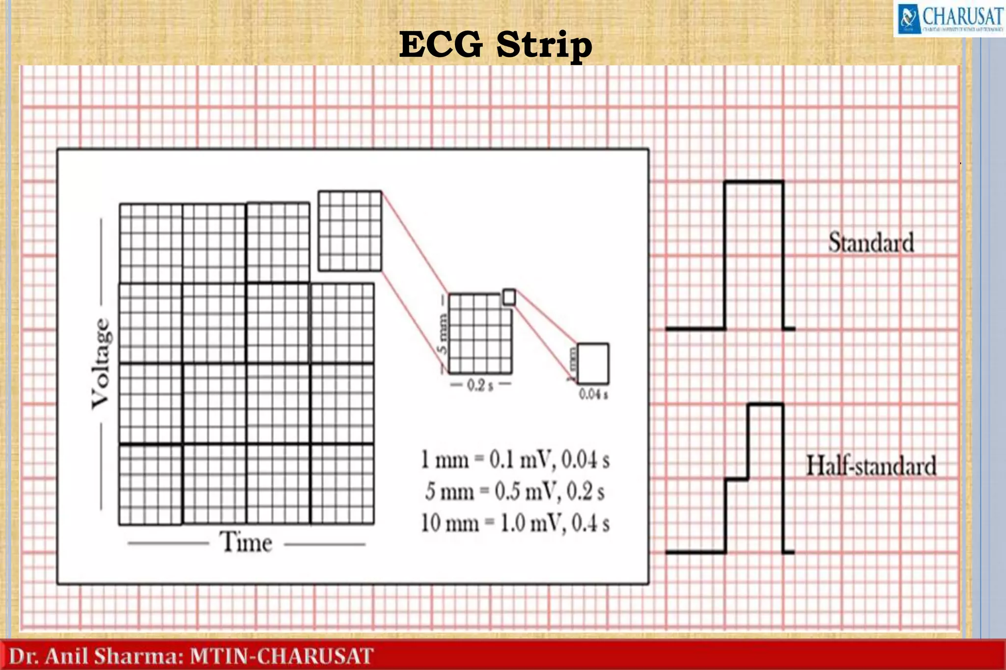 ECG Strip
• It is a piece of paper used to record ECG.
• ECG paper consist of horizontal and vertical
lines forming a grid.
• Horizontal axis represent time.
• Small block-0.04 second
• 5 small block create one large block-.2 second
• 5 large block- 1 second
• Vertical axis represent amplitude in millimeters
(mm) or electrical voltage in millivolts (mV).
• Small block-1 mm or 0.1 mV
• Large block- 5 mm or 0.5 mV
17
 