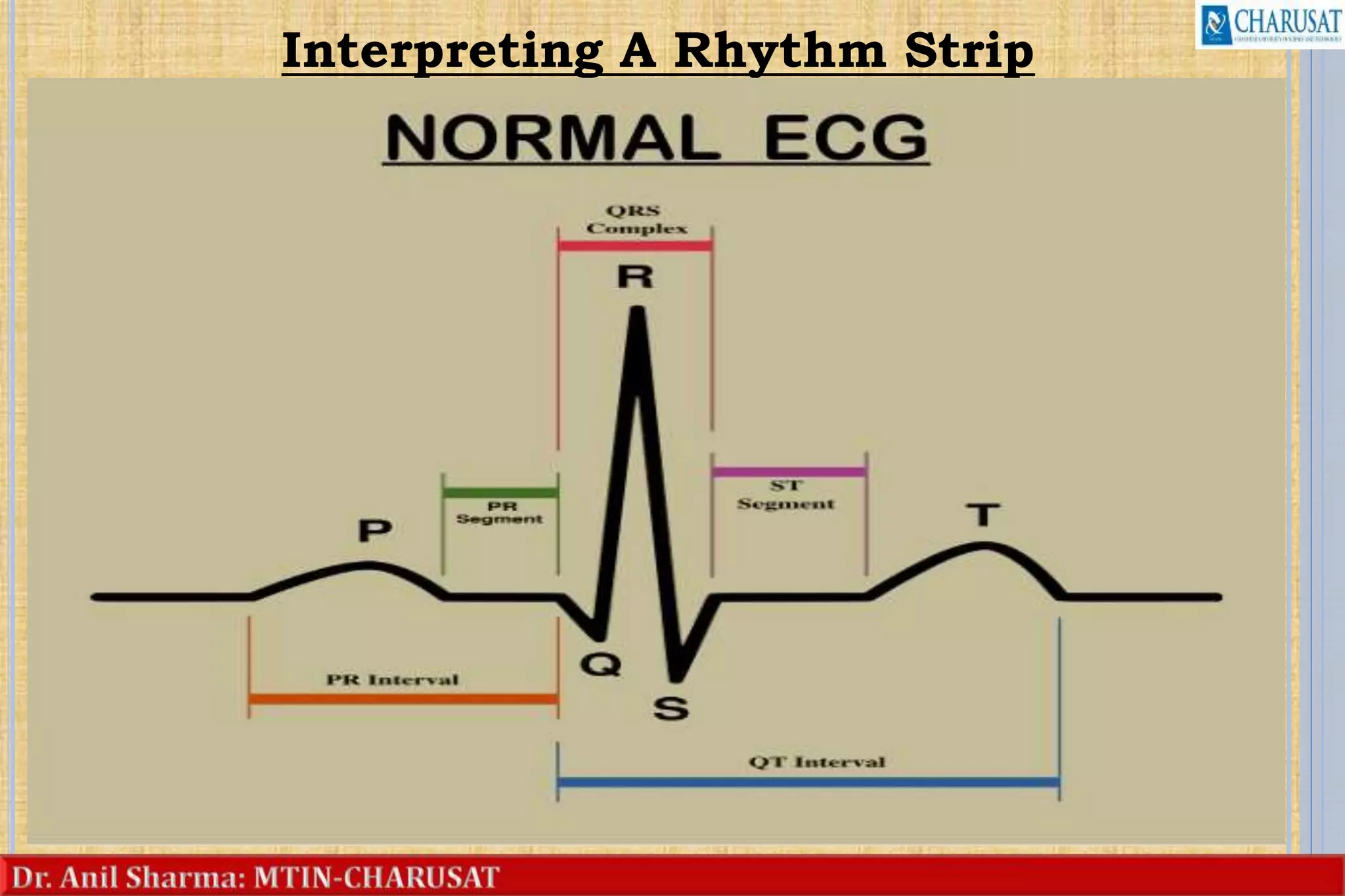 Interpreting A Rhythm Strip
18
 