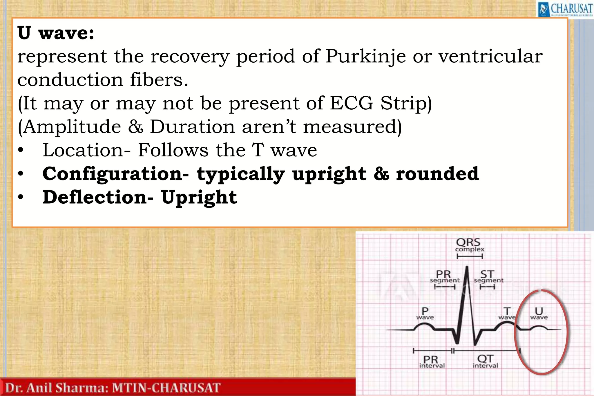25
U wave:
represent the recovery period of Purkinje or ventricular
conduction fibers.
(It may or may not be present of ECG Strip)
(Amplitude & Duration aren’t measured)
• Location- Follows the T wave
• Configuration- typically upright & rounded
• Deflection- Upright
 